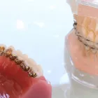 矯正